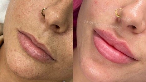 323681511_119384724360364_8345824644202804029_n