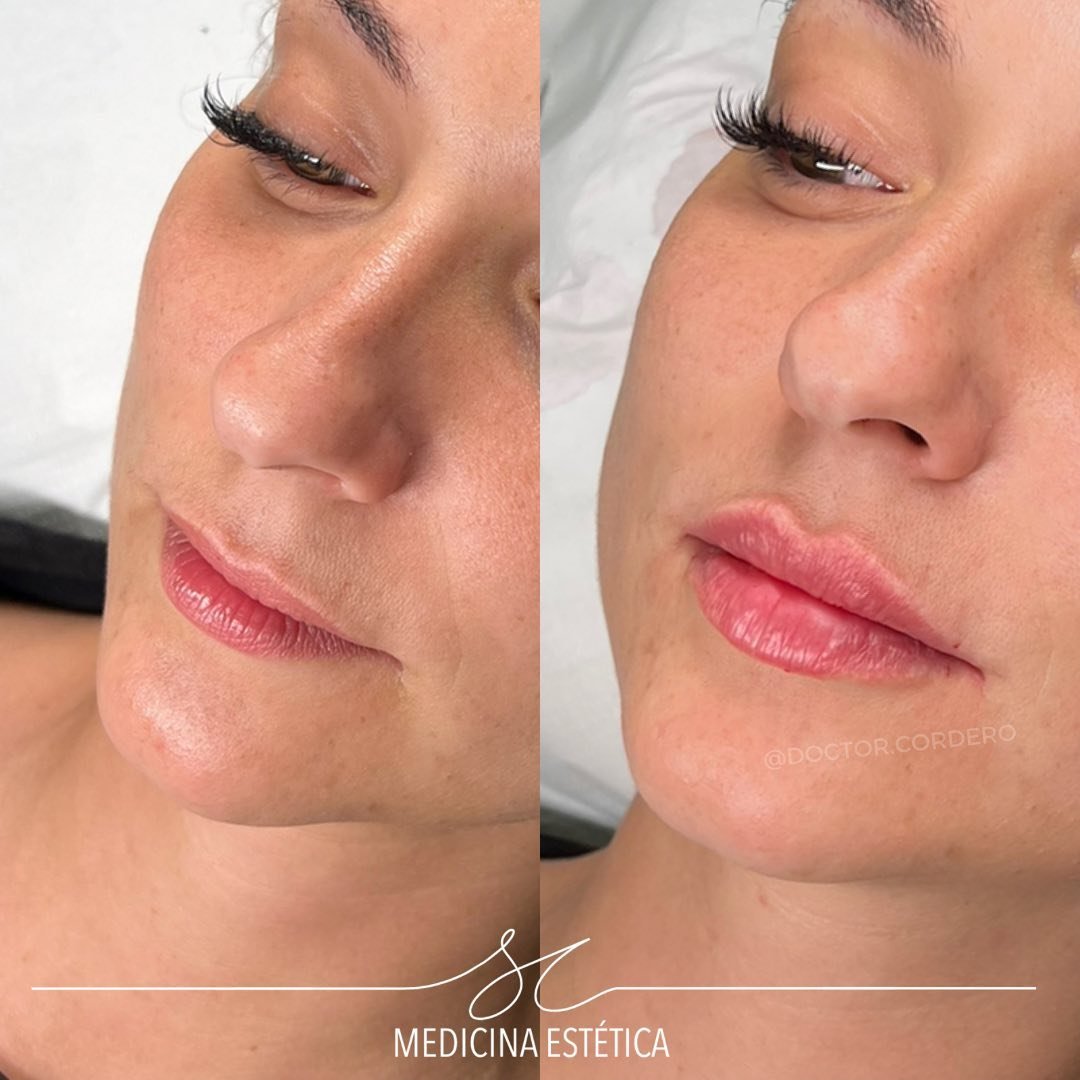 medicina-estetica-4